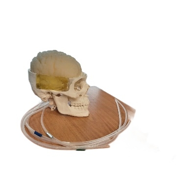 Фантом для исследования сосудов через кости черепа с использованием средств ультразвуковой визуализации