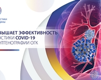 ИИ повышает эффективность диагностики COVID-19 при рентгенографии ОГК