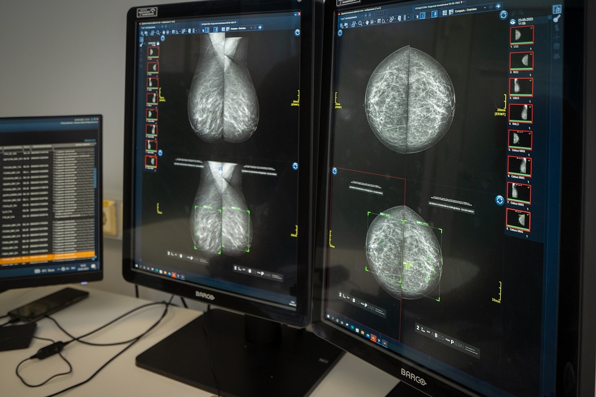 В 2023 году нейросети помогли проанализировать 100 тысяч маммографических исследований пациентов