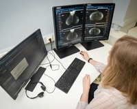 Анастасия Ракова привела статистику использования нейросетей для анализа маммограмм