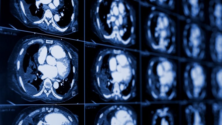 Diagnostics specialists’ take on the accuracy of CT scans
