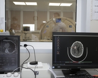 В Москве искусственный интеллект теперь помогает находить ишемический инсульт на КТ головного мозга