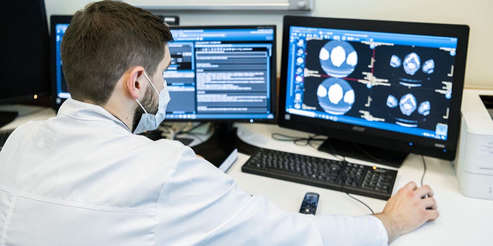 Искусственный интеллект помог рентгенологам обработать более 3 миллионов исследований