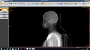 вариант сканирования головы